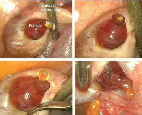 排卵過程實景圖